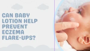 Can Baby Lotion Help Prevent Eczema Flare-Ups?