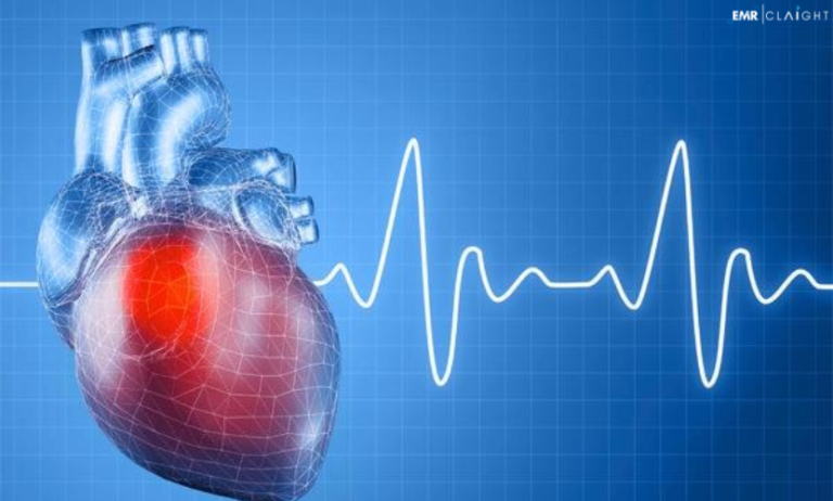 Global Cardiac Rhythm Management Devices Market Outlook, Segments, Trends & Forecast | 2024 – 2032