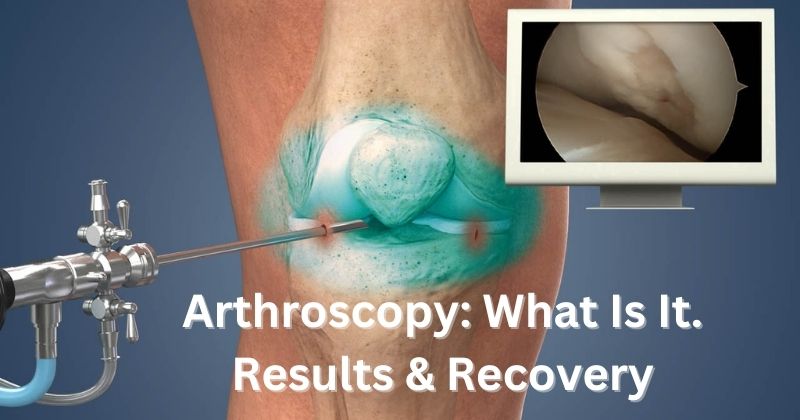 arthroscopy