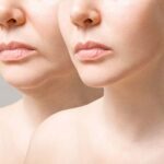 What Are Some Non-Surgical Alternatives for Facial Plastic Surgery?