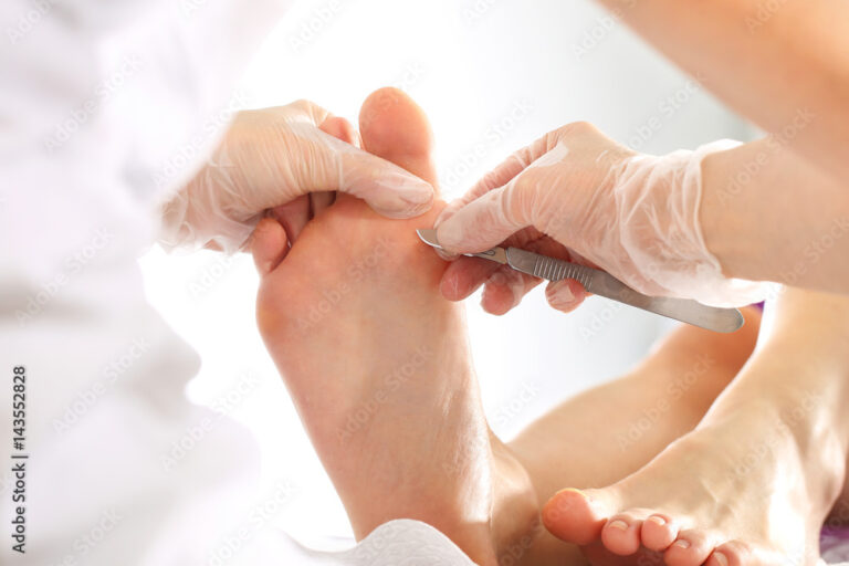 Top Footcare Clinic for Podiatry in Edinburgh