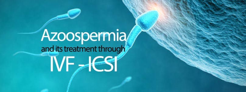 azoospermia treatment