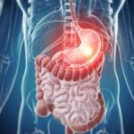 What is Gastritis?