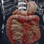 Intestine Transplant: Myths and Facts You Should Know