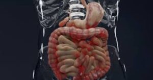 Intestine Transplant