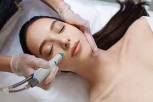 HydraFacial Benefits for Pigmentation: Your Guide to Radiant Skin