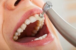 Is deep teeth cleaning in Boise, Idaho, really necessary?