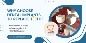 Losing a Tooth? Here’s Why Dental Implants Are Your Ideal Replacement