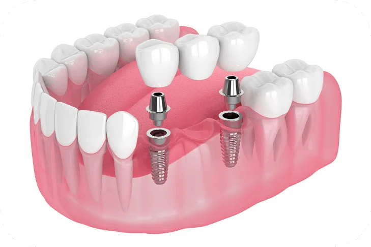 Oral Surgery in Aberdeen: A Comprehensive Guide