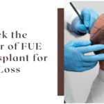 Unlock the Power of FUE Transplant for Hair Loss