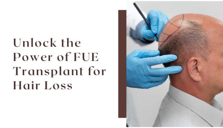 Unlock the Power of FUE Transplant for Hair Loss