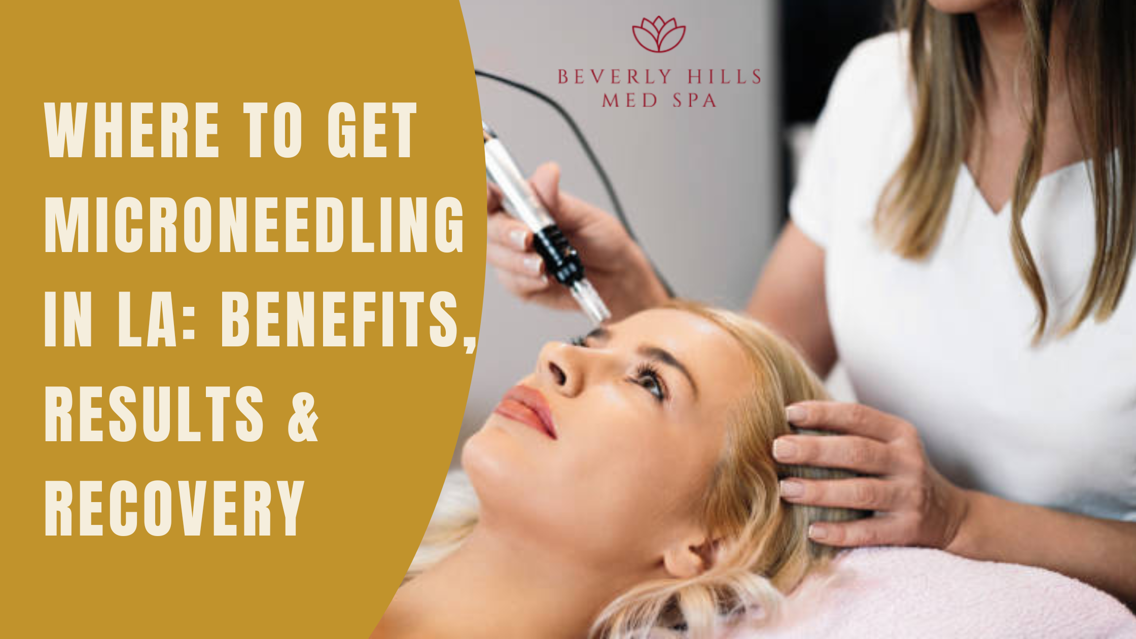 microneedling la