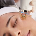 Improve Skin Tone with Microneedling Treatment
