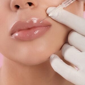 Smooth, Shape, and Plump Lips with Advanced Filler Solutions: