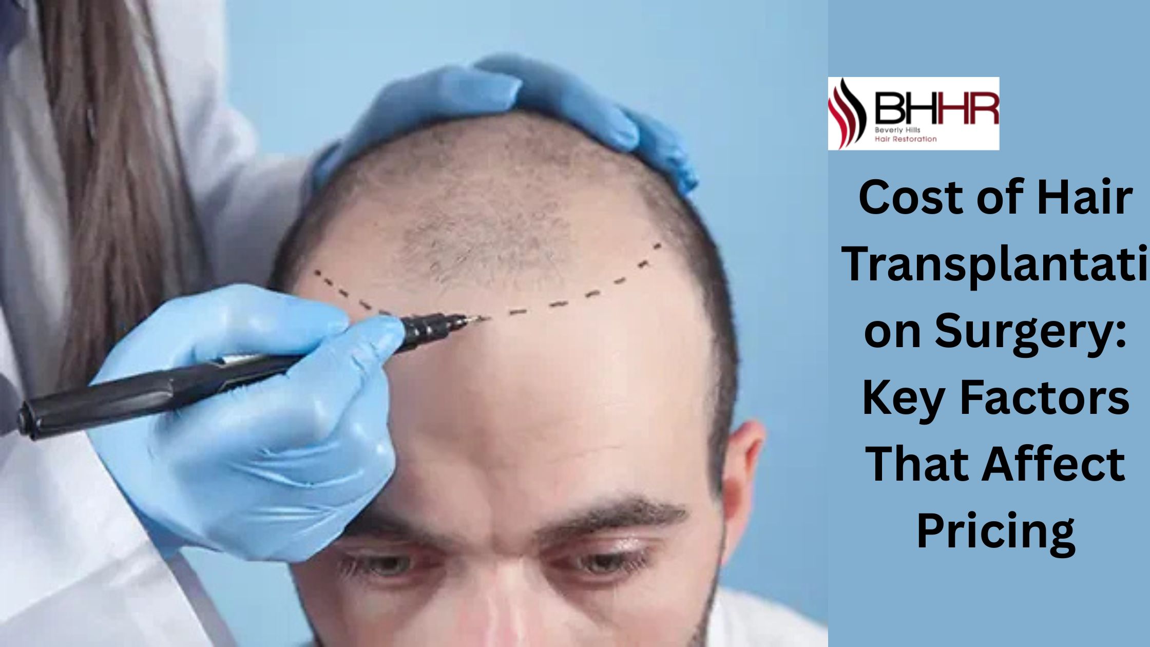 cost of hair transplantation surgery