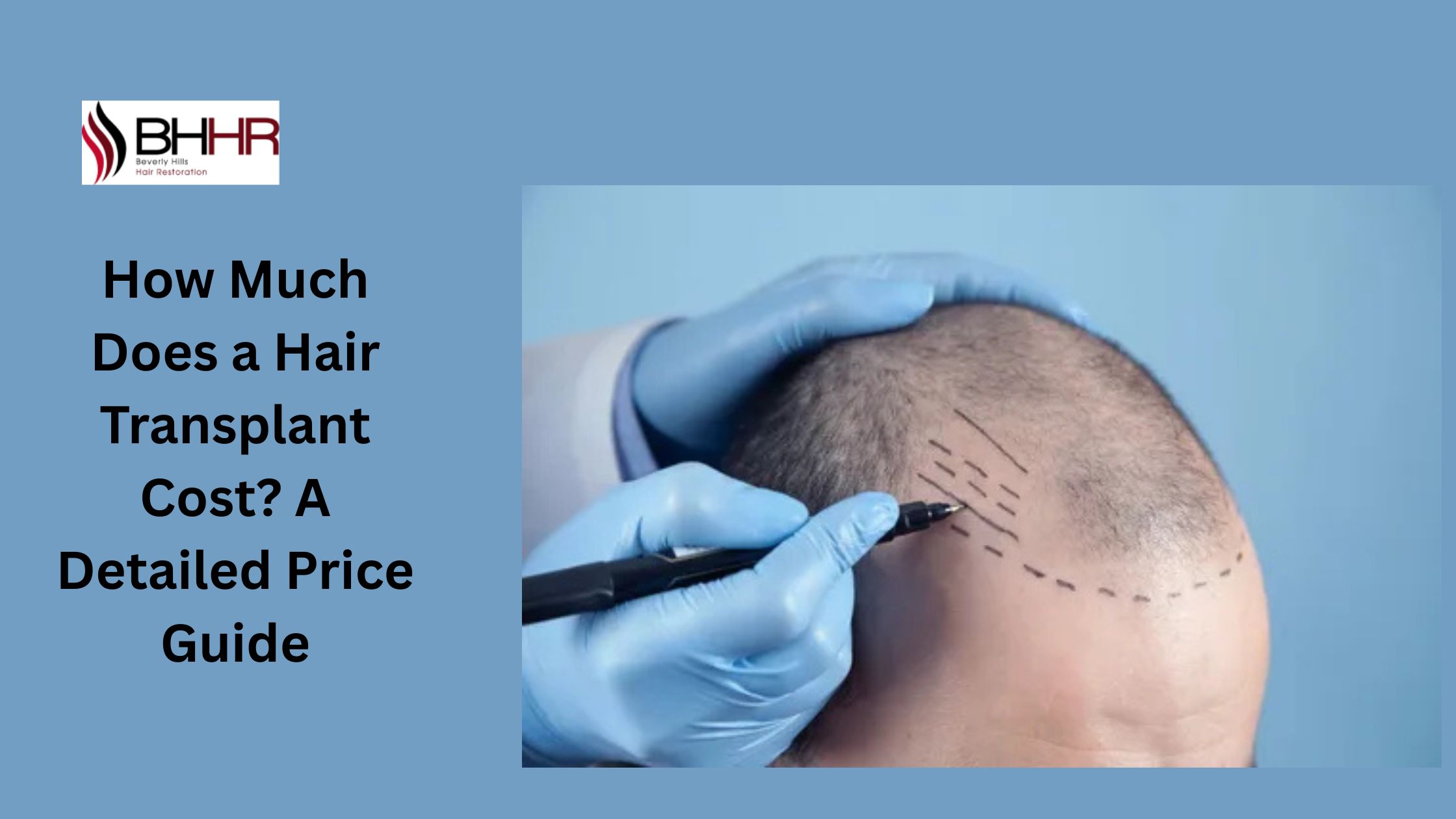 hair transplant price