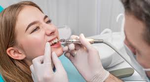Teeth Cleaning Benefits for Healthy and Bright Smile