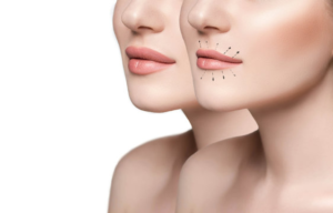 Breast Augmentation Guide and Lip Augmentation Costs