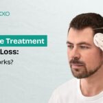 Exosome Treatment for Hair Loss: How It Works? 