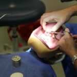 How to Choose Hands-on Dental Implant Training in Your Area?