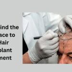 How to Find the Best Place to Get Hair Transplant Treatment
