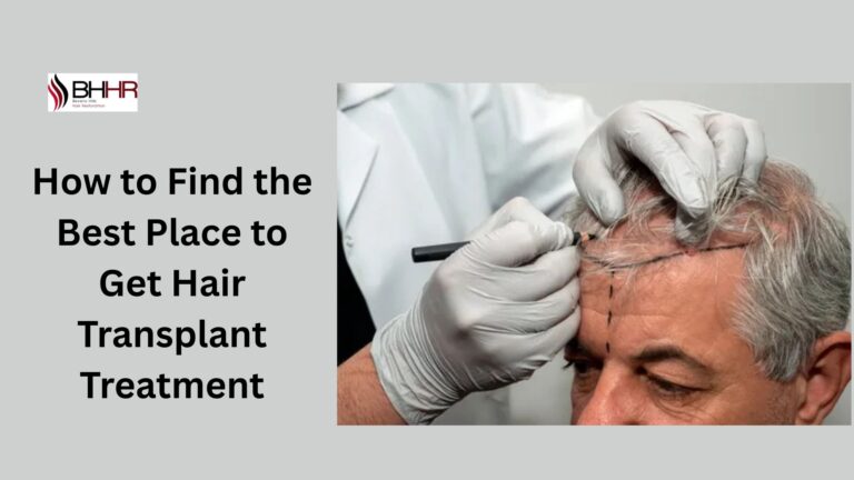 How to Find the Best Place to Get Hair Transplant Treatment