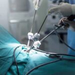 Minimally Invasive Techniques for Better Recovery