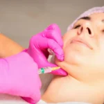 How Much Does Kybella Cost Per Treatment Session?