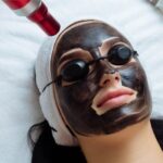 Laser Carbon Peel vs Chemical Peel: Key Differences