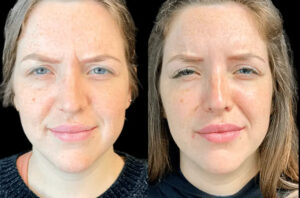 How the Best Doctors in Dubai Help Prevent Premature Aging with Botox