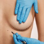 Breast Lift in Dubai: Risks You Should Know Before Surgery
