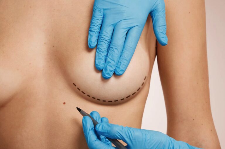 Breast Lift in Dubai: Risks You Should Know Before Surgery