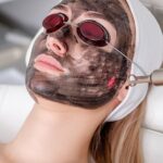 Laser Carbon Peel vs Microneedling: Which Wins?