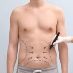 A Patient’s Guide to Abdominoplasty Surgery in Islamabad
