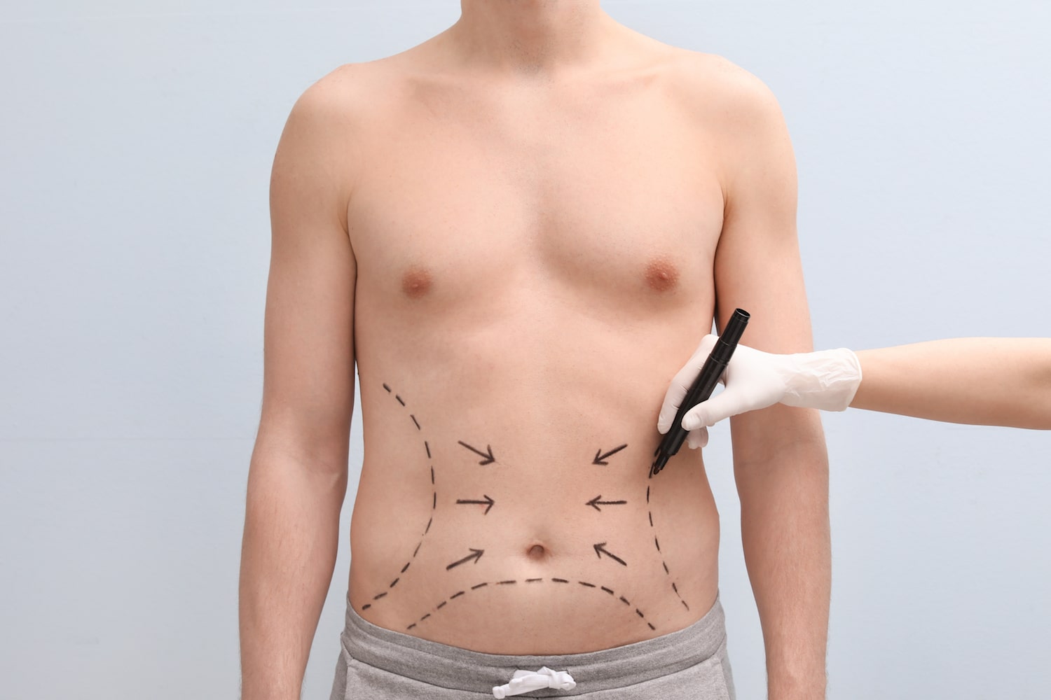 abdominoplasty in Islamabad