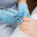 Common Foot Problems in Diabetic Patients and How a Podiatrist Can Help