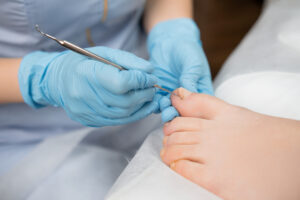 Common Foot Problems in Diabetic Patients and How a Podiatrist Can Help