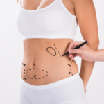 Liposuction Surgery in Dubai for Targeted Fat Removal and Body Enhancement