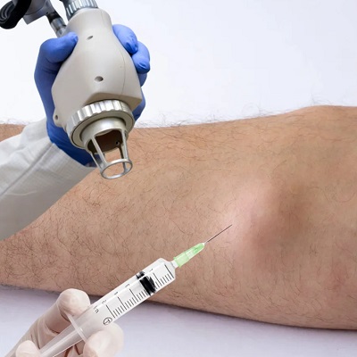Who Should Consider Lipoma Treatment in Oman?